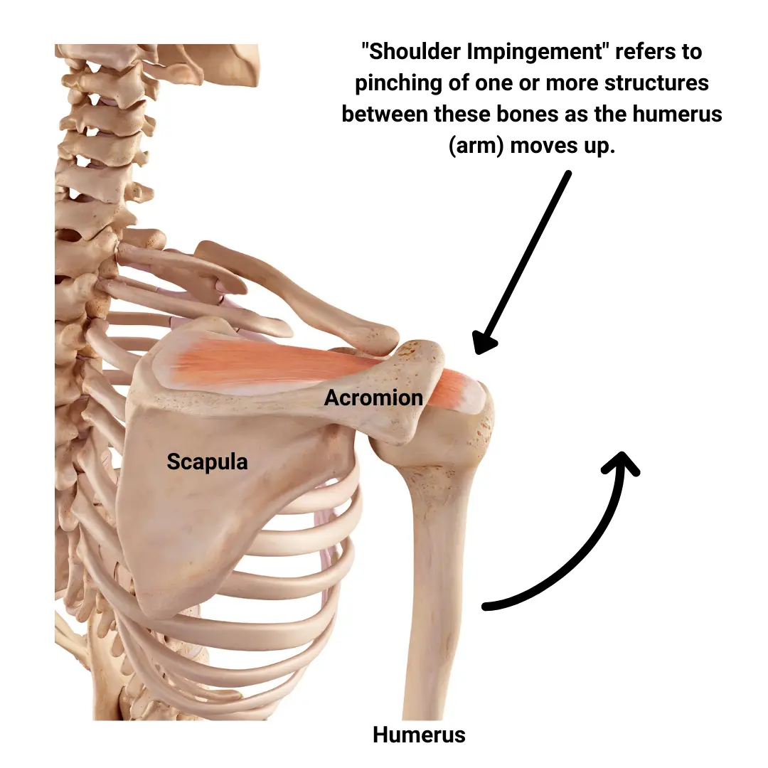 What is shoulder impingement? 